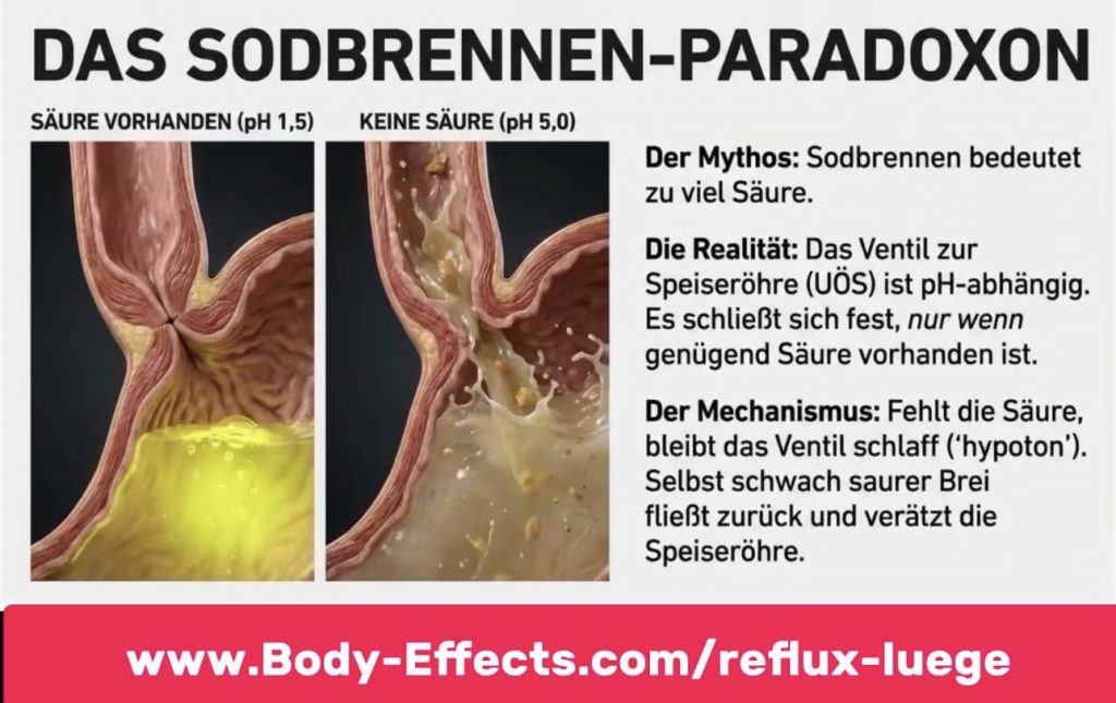 Sodbrennen Paradoxon