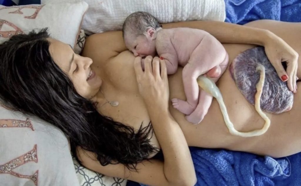 Neugeborenes mit Nabelschnur und Plazenta