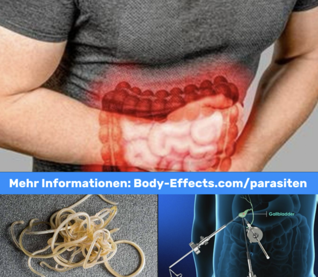 Gallenblase und Parasitenbefall