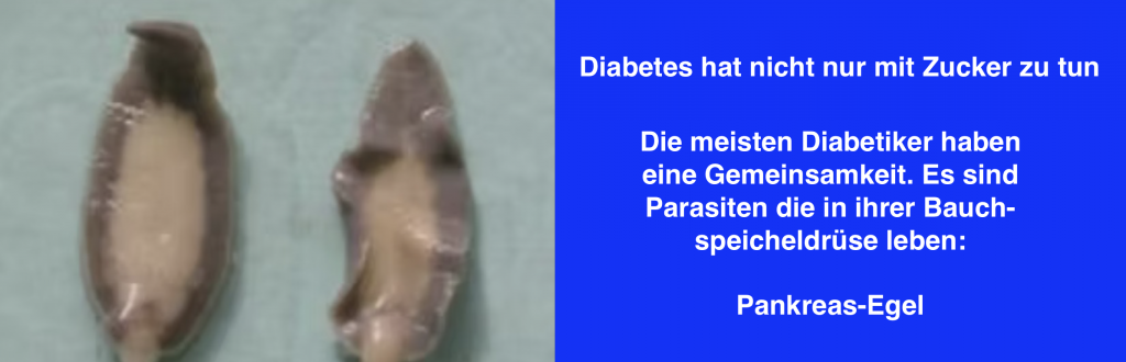 Pankreas Egel
