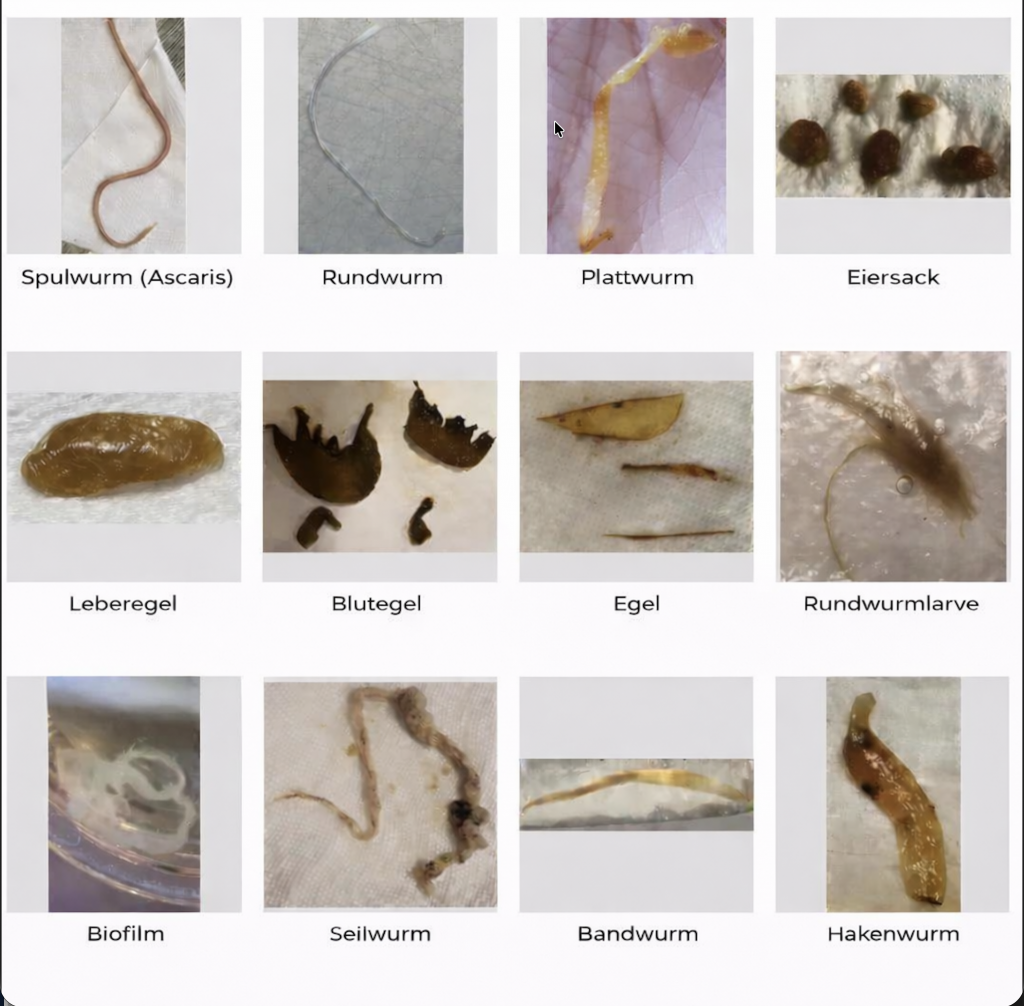 Parasiten im menschlichen Körper