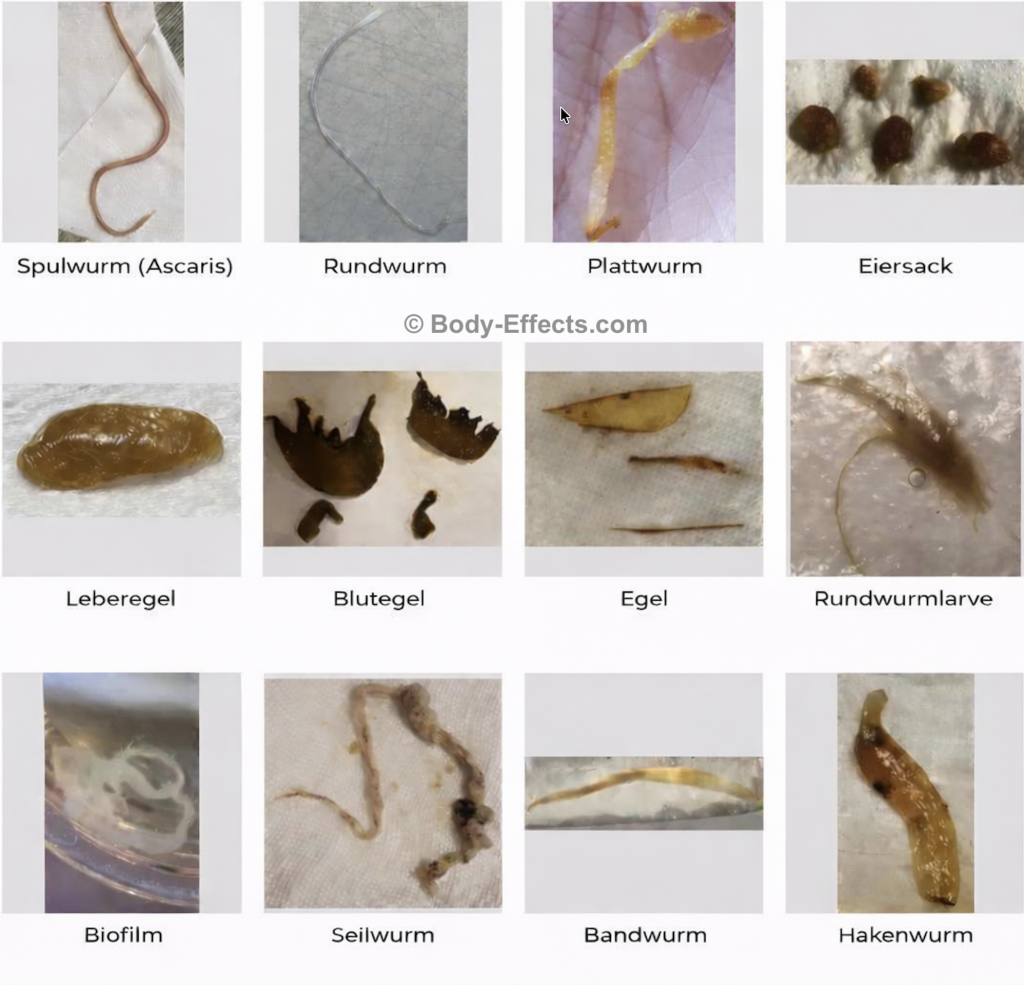 Parasiten im menschlichen Körper